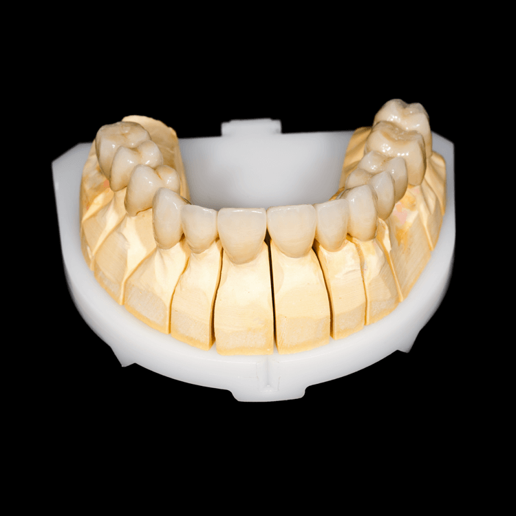 CAD-CAM-Crowns-and-Bridges